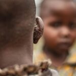 Ebola en RDC : une épidémie qui ressurgit à l&rsquo;est, aux portes de l&rsquo;Ouganda